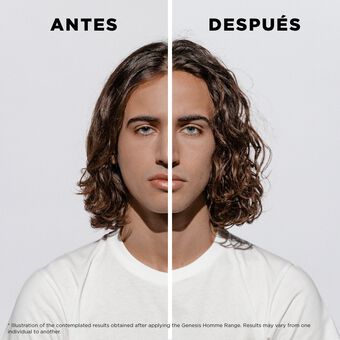 Serum Anti-Chute Fortifiant