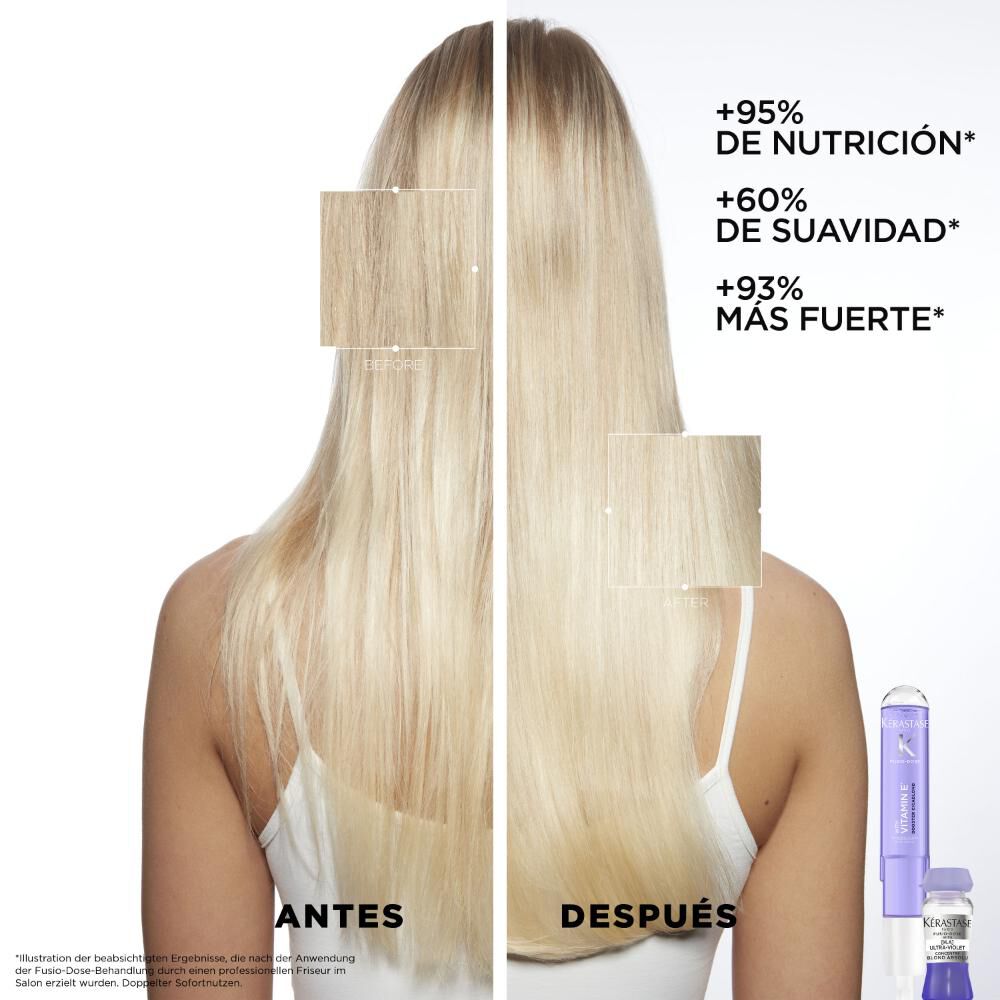 Fusio-Dose