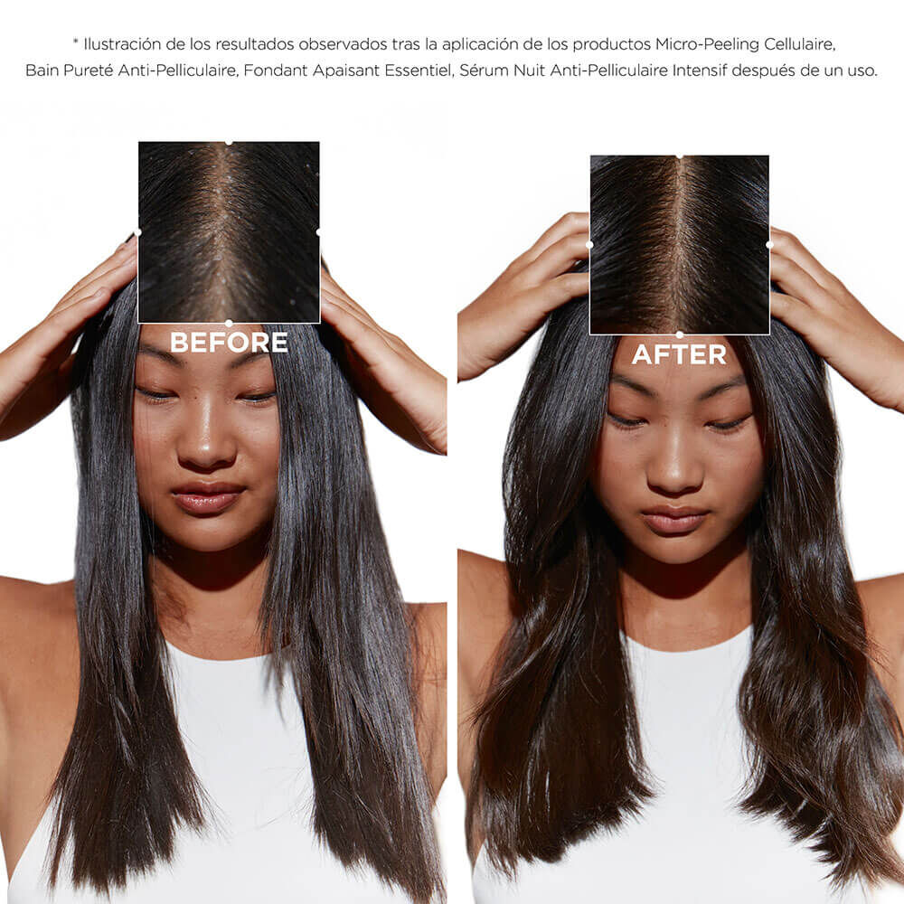 Cuarteto Symbiose anticaspa para el cuero cabelludo graso y sensible