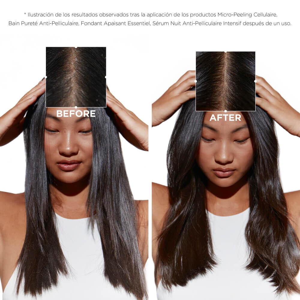 Trio Symbiose anticaspa para el cuero cabelludo graso